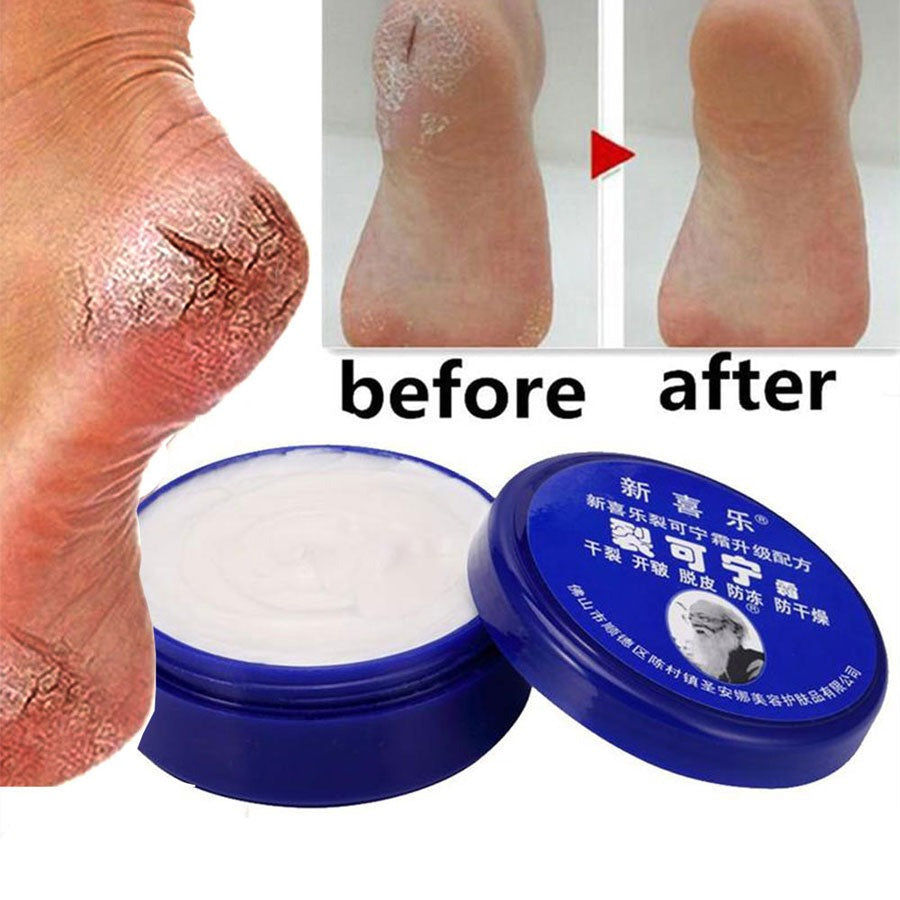 Traditional 33g Oil Anti-Drying Crack Foot Cream - WMV LLC